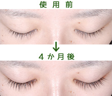まつ育の使用前・使用後イメージ